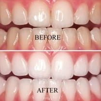 FIRST CHOICE DENTAL CARE gallery photo