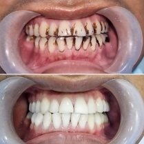 FIRST CHOICE DENTAL CARE gallery photo
