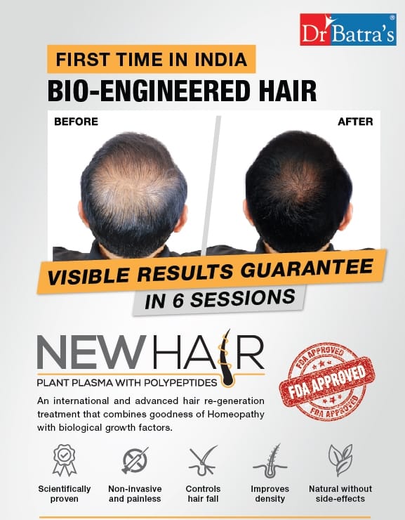 Hairs never come back if you are above 25 yr old. - DR BATRA'S CLINIC -  JANAKPURI - DELHI Consumer Review - MouthShut.com