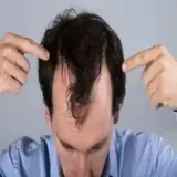 HAIR WIGS